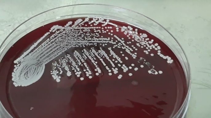 Citrobacter Koseri: Symptoms, Risks, Treatment, and What You Should Know citrobacter koseri